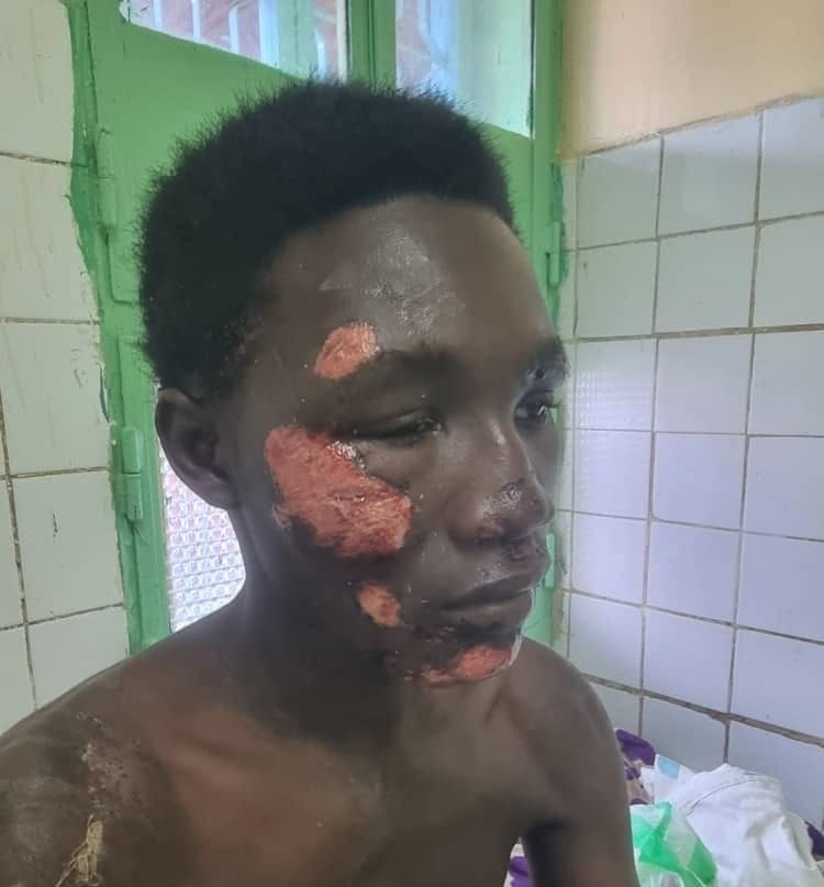Tchad : agression près du camp 27